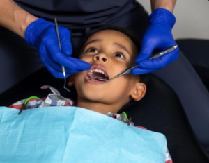 Read more about the article When Should You Take Your Child for Their First Dental Visit?