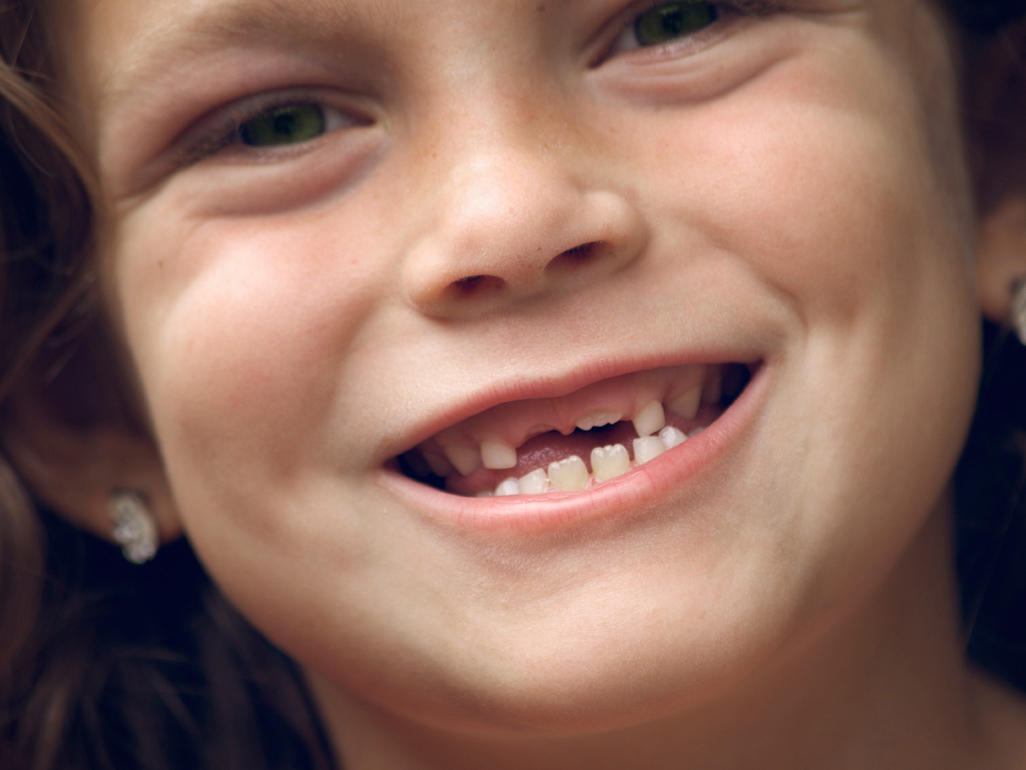Read more about the article Permanent Teeth Development Behind Baby Teeth: Is It Normal?